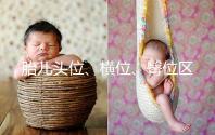 胎兒頭位、橫位、臀位區(qū)別大,5個(gè)方面教你分辨