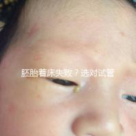 胚胎著床失敗?選對(duì)試管嬰兒醫(yī)生很重要