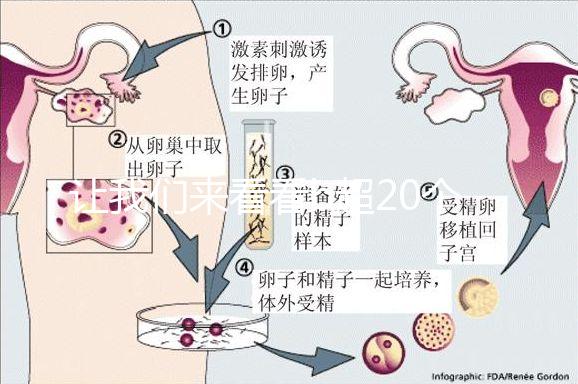 讓我們來看看b超20個卵子取10個是不正常的我們該怎么辦？