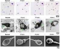 補(bǔ)充葉酸？elevit愛樂維那你不得不了解