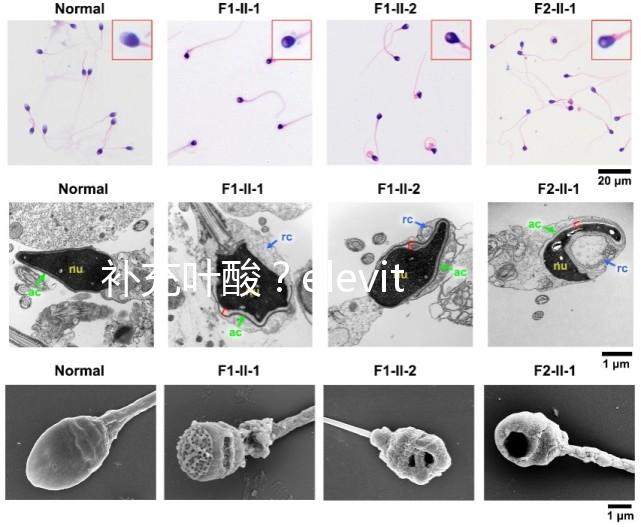 補(bǔ)充葉酸?elevit愛(ài)樂(lè)維那你不得不了解