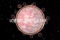 試管嬰兒移植懷孕14天，還能吃巧克力餅干嗎？