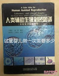 試管嬰兒做一次需要多少錢(qián)