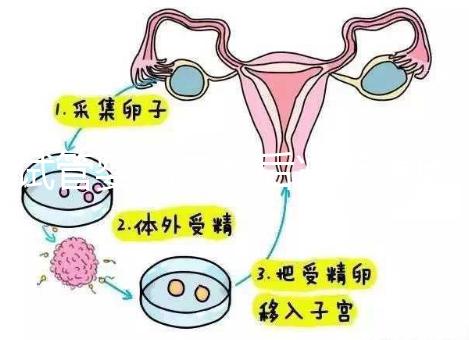 試管嬰兒二超后減藥原因已找到，對胎兒沒影響別瞎擔心