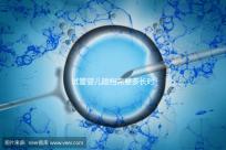 試管嬰兒建檔需要多長(zhǎng)時(shí)間進(jìn)來瞧,內(nèi)含詳細(xì)流程供參考