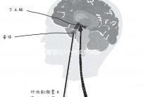 試管嬰兒5個月流產原因有三,多久能再次移植需慎重考慮