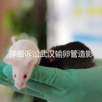 詳細訴訟武漢輸卵管造影檢查多少錢，能否報銷，不要錯過