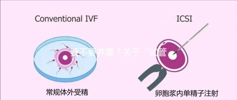 要不要養(yǎng)囊？關(guān)于“試管養(yǎng)囊”你是否會(huì)有很多問號(hào)？
