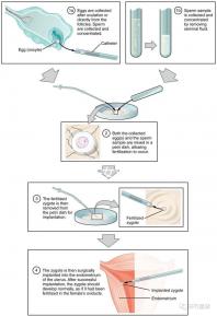貴陽未婚子女戶口如何向婦女介紹，附2024年結算流程