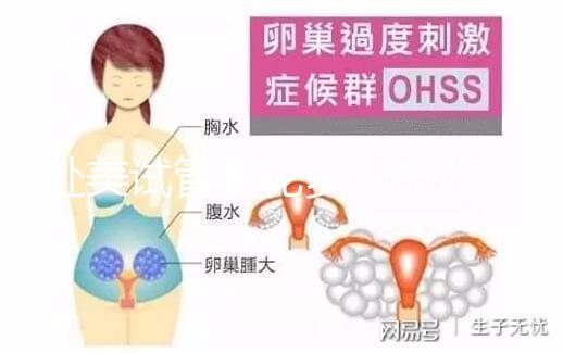 赴美試管要花多少錢(qián)?5大收費(fèi)看懂美國(guó)試管嬰兒貴在哪里