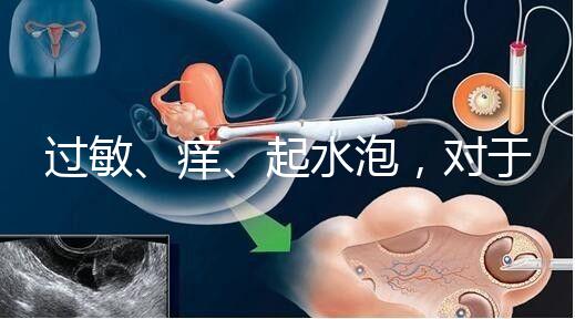 過敏、癢、起水泡，對于三伏貼的副作用你需知道該怎么辦