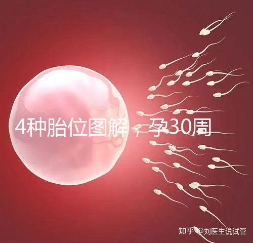 4種胎位圖解,孕30周這個(gè)姿勢最適合順產(chǎn)