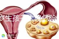 39歲生孩子太晚危險(xiǎn)大別不care，進(jìn)來聽聽生二胎真實(shí)感受