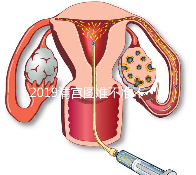2019清宮圖準(zhǔn)不準(zhǔn)不知道，但檢測生男女這3種方法才科學(xué)