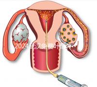 2024武漢免費(fèi)葉酸外國(guó)人可以領(lǐng)取,符合條件就來江漢區(qū)