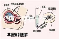 tct檢查后癥狀一覽，專家提醒做好處理措施是關(guān)鍵